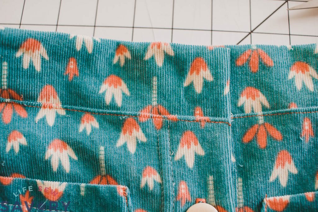 add button to front placket